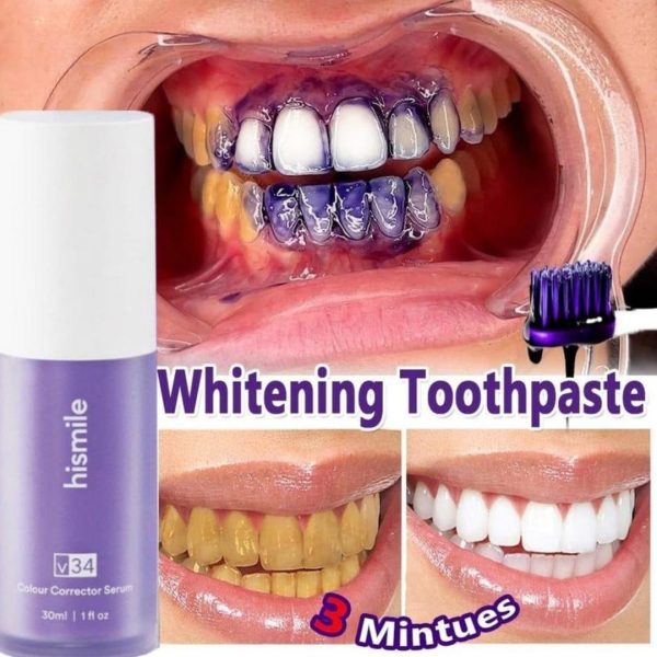 Teeth Brightening Duo – V34 Serum + Soft Brush