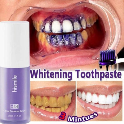 Teeth Brightening Duo – V34 Serum + Soft Brush